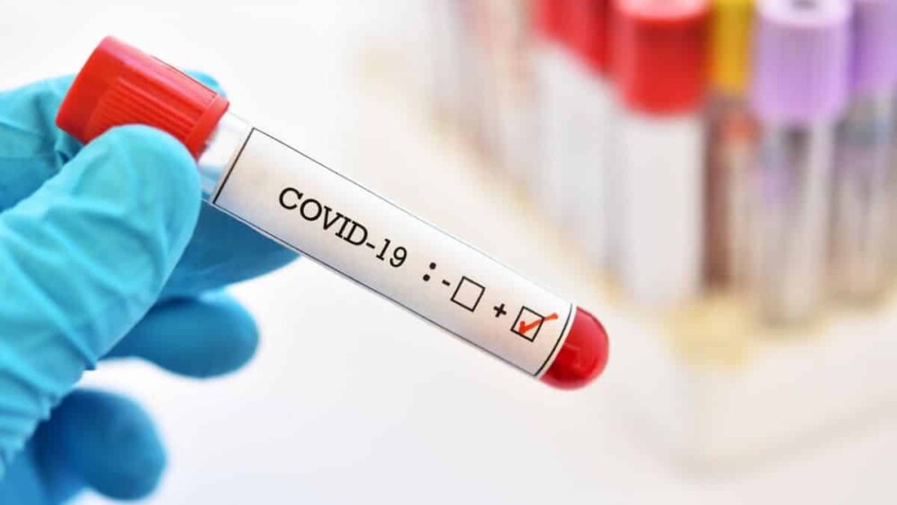 Covid-19: USP confirma primeiro caso de reinfecção no país